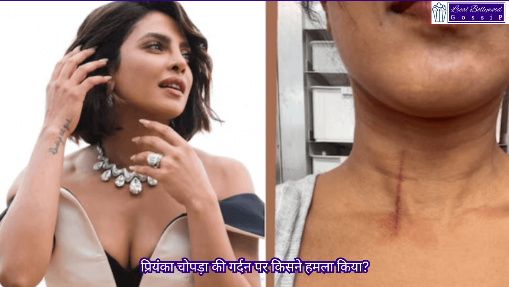 प्रियंका चोपड़ा की गर्दन पर किसने हमला किया? | Who attacked Priyanka Chopra’s neck?